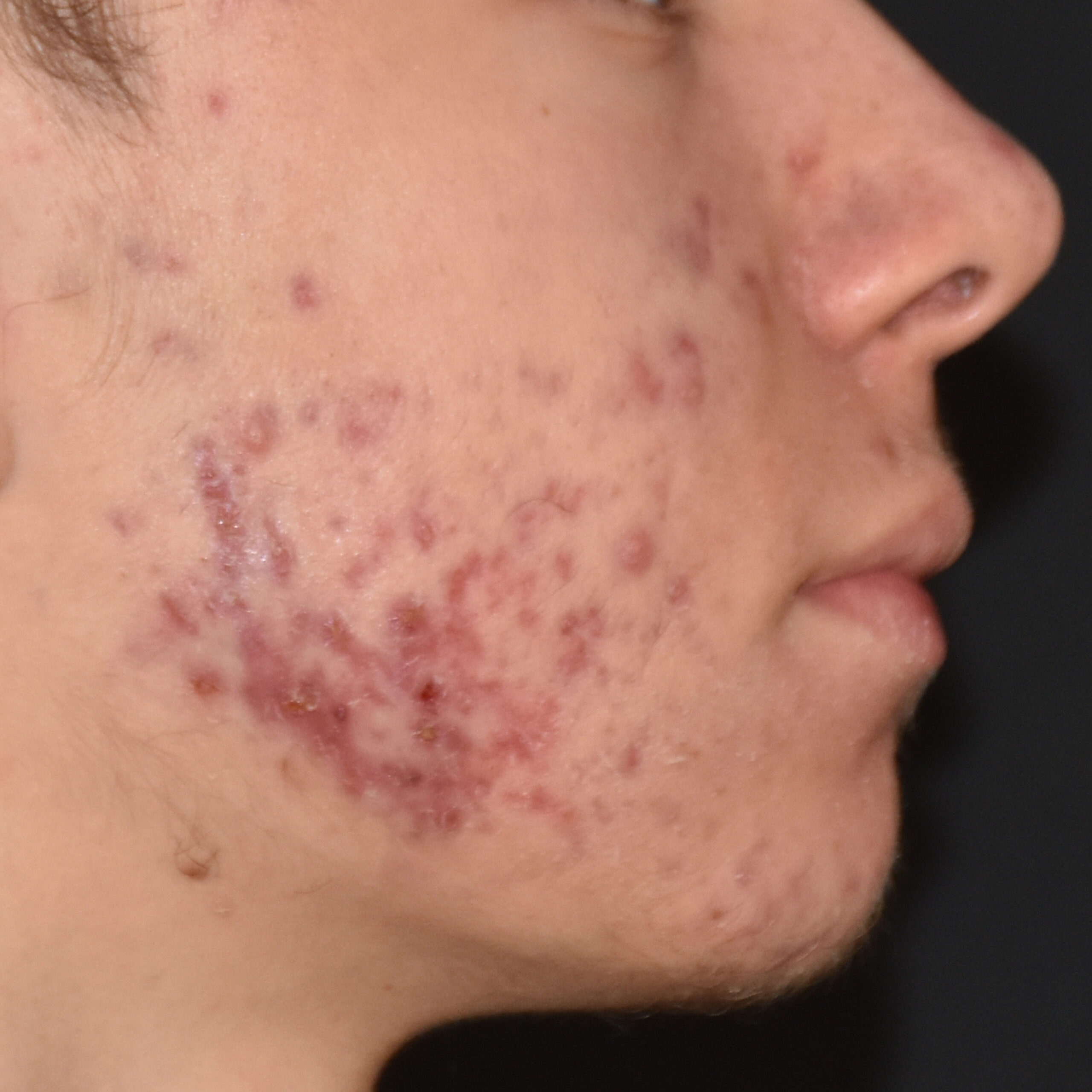 Case--8164 | Before Face Treatments 3