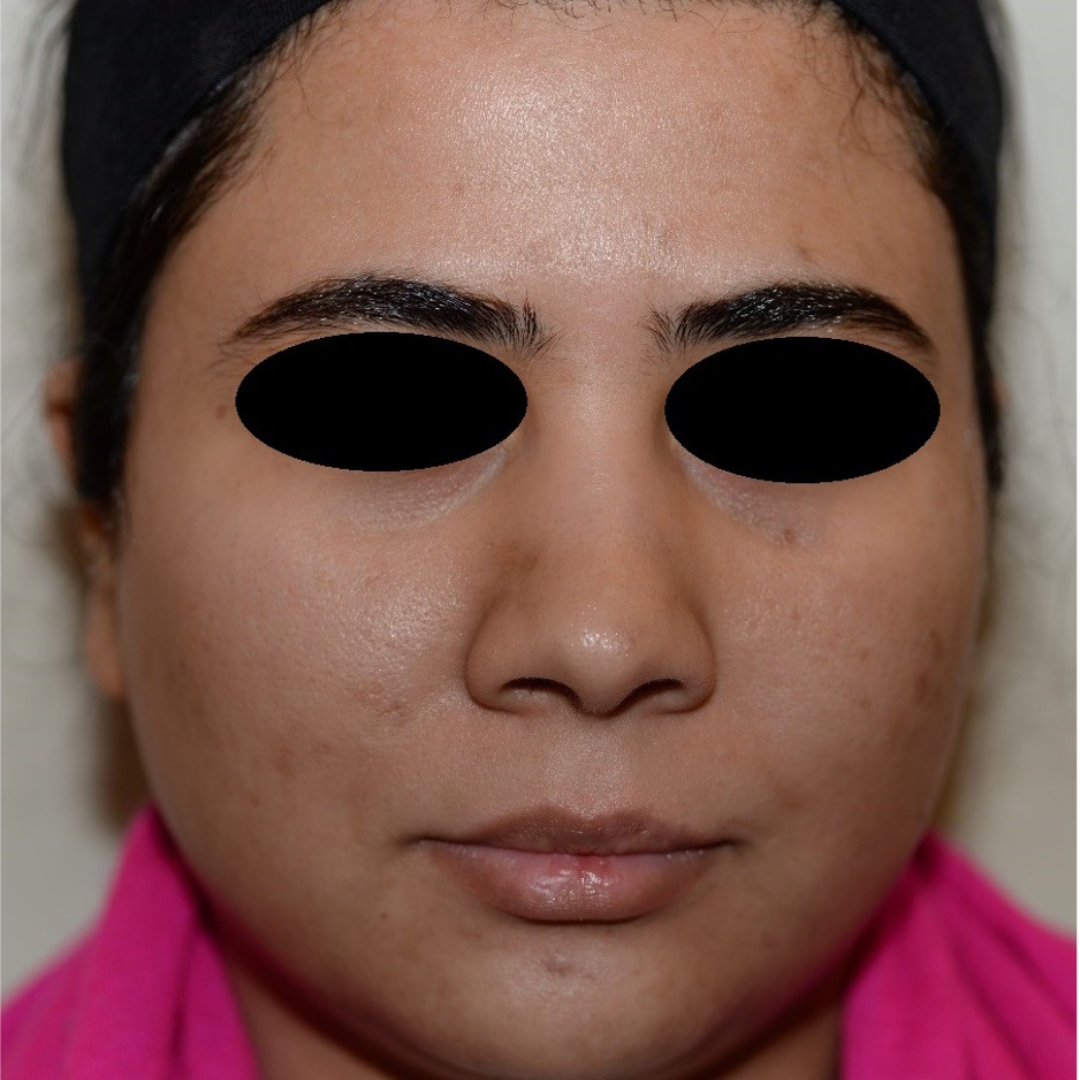 Case--2119 | Before Medical Grade Skincare