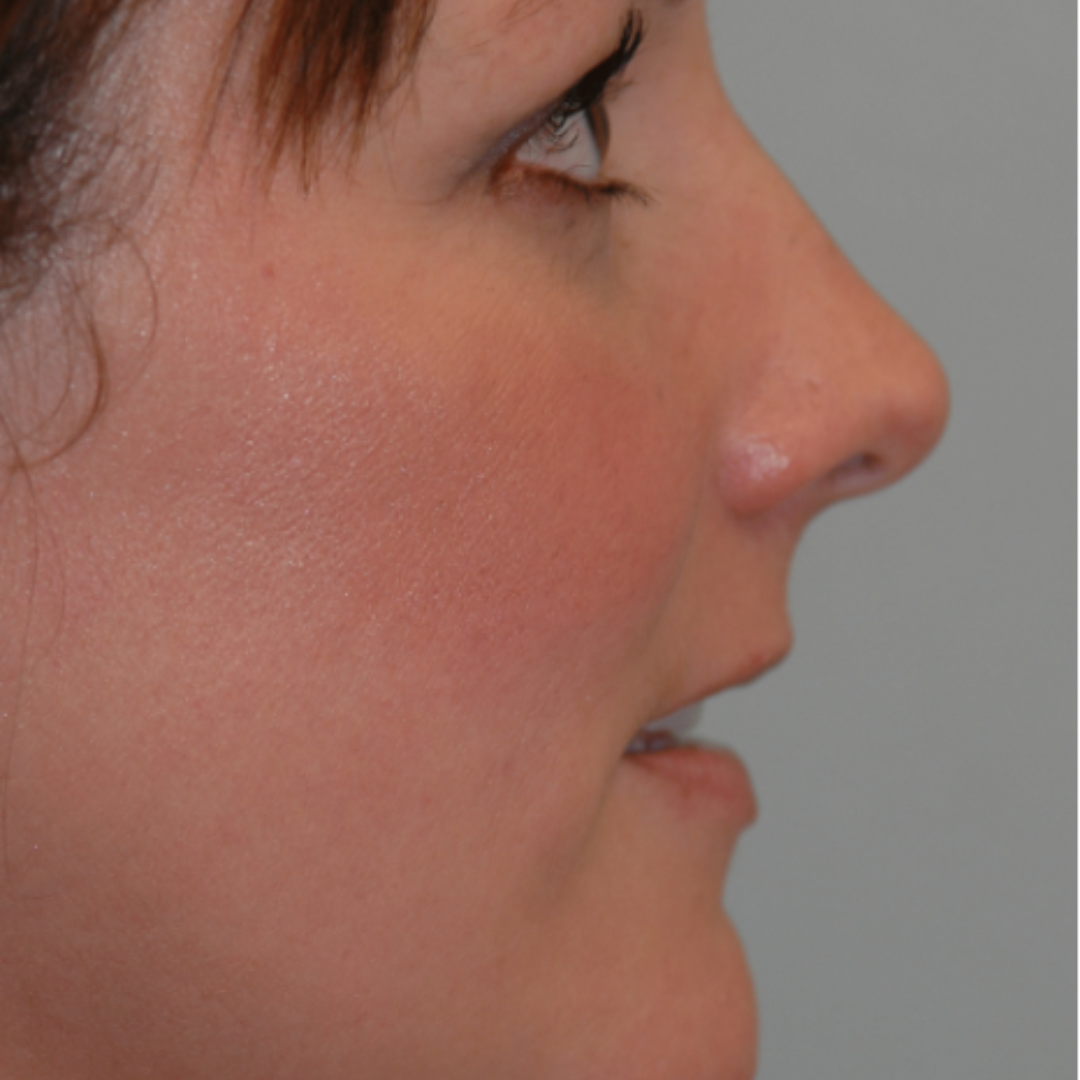 Case--9236 | After Medical Grade Skincare