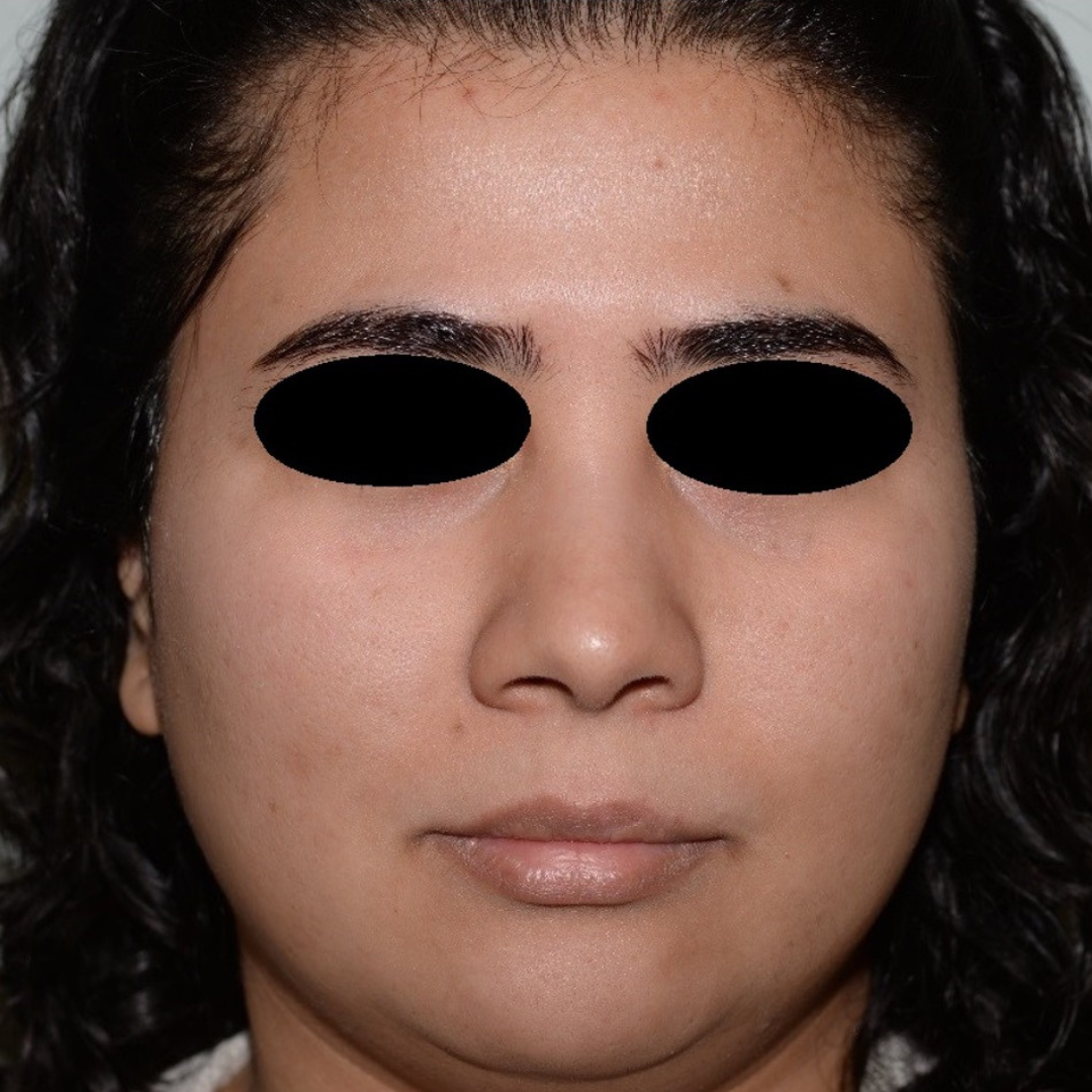 Case--2119 | After Medical Grade Skincare