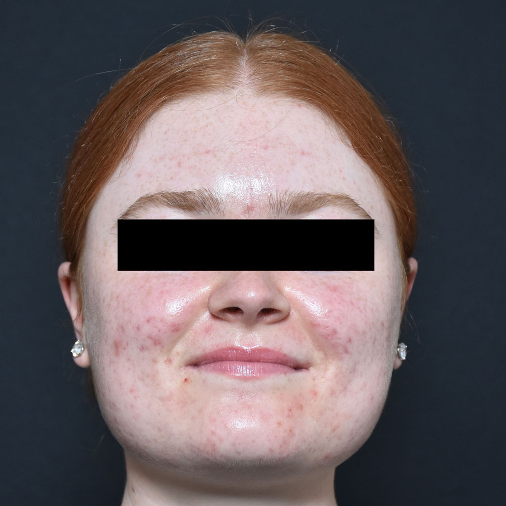 Case--2122 | After Face Treatments