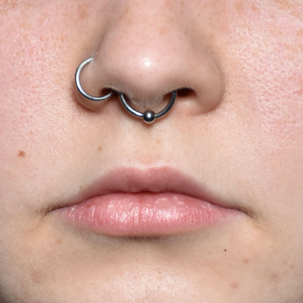 Case--2147 | Before Face Treatments