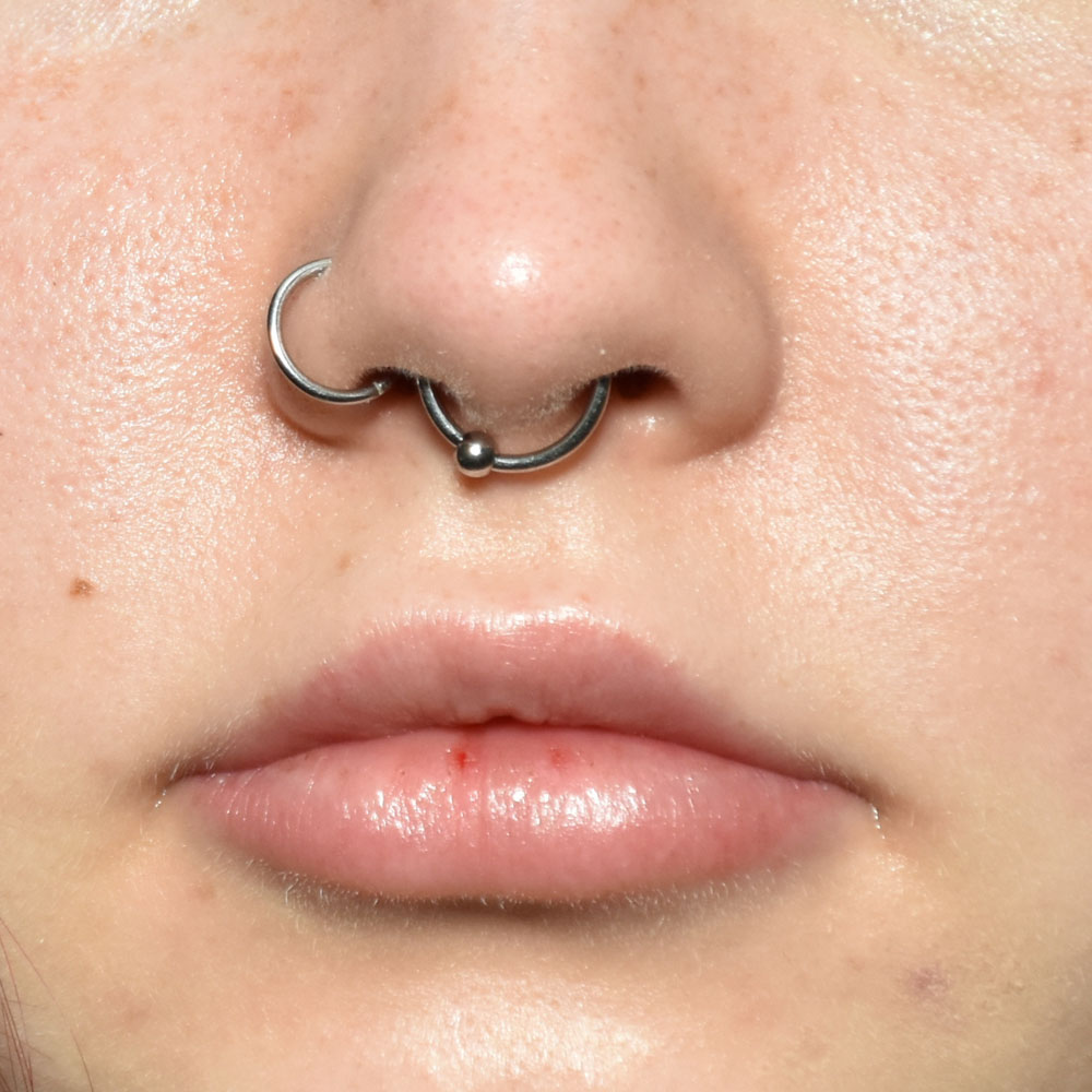 Case--2147 | After Face Treatments