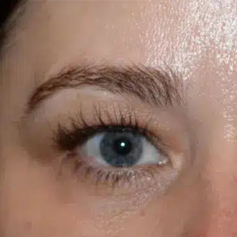 Case--2137 | Before Face Treatments